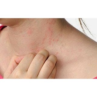 combo 3 tuýp kem bôi, ngoài da hỗ trợ nấm ngứa, chàm, tổ đỉa, ghẻ nước, hắc lào, lang ben Vàng Tên Lửa - Hàng Chính Hãng