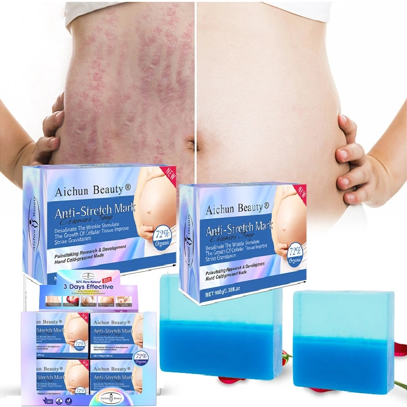 Xà Phòng Hỗ trợ Mờ Rạn Da, Mờ Thâm Sạm Da, trắng da Aichun Beauty