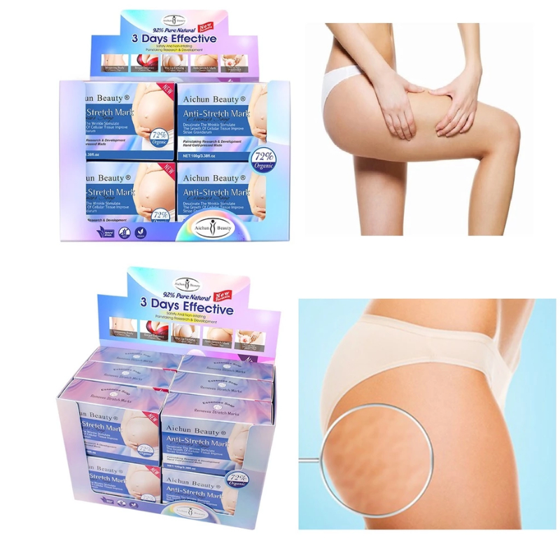 Xà Phòng Hỗ trợ Mờ Rạn Da, Mờ Thâm Sạm Da, trắng da Aichun Beauty
