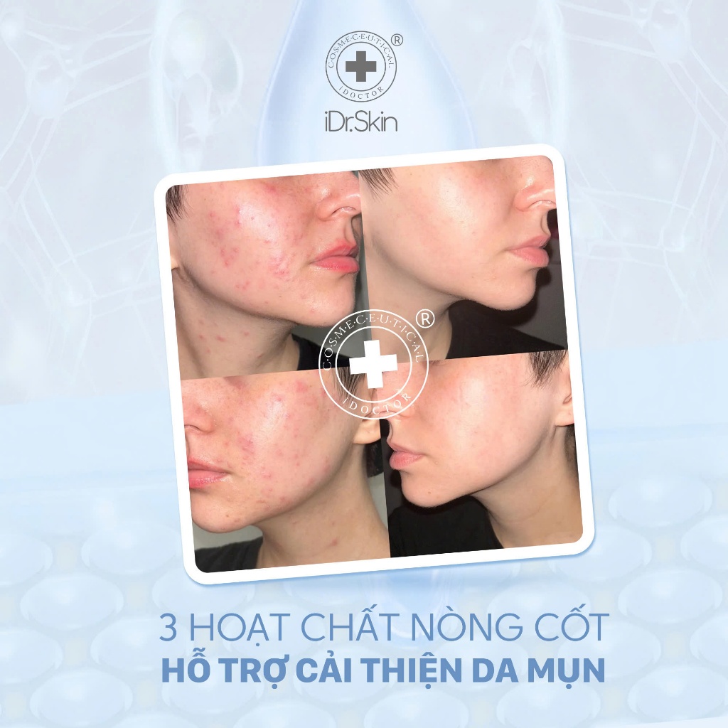 [iDr.Skin Chính Hãng]Sữa rửa mặt lên men sạch sâu IDr.Skin Facial Cleansing Gel hỗ trợ phục hồi phục hồi và tái tạo 120g
