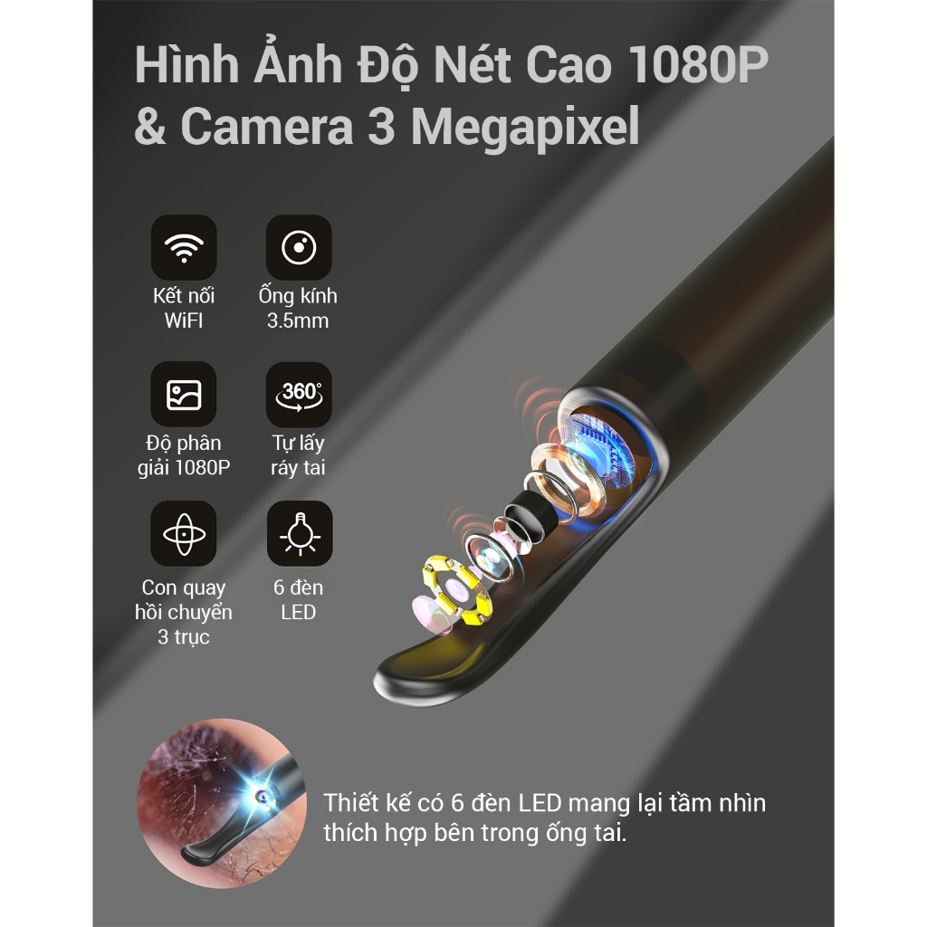 Ảnh Dụng Cụ Lấy Ráy Tai Bebird X0 2