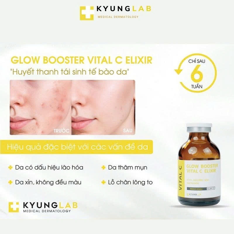 Serum huyết thanh KYUNGLAB GLOW BOOSTER VITAL C ELIXIR 30ML hỗ trợ da sáng, đều màu, ngừa lão hoá