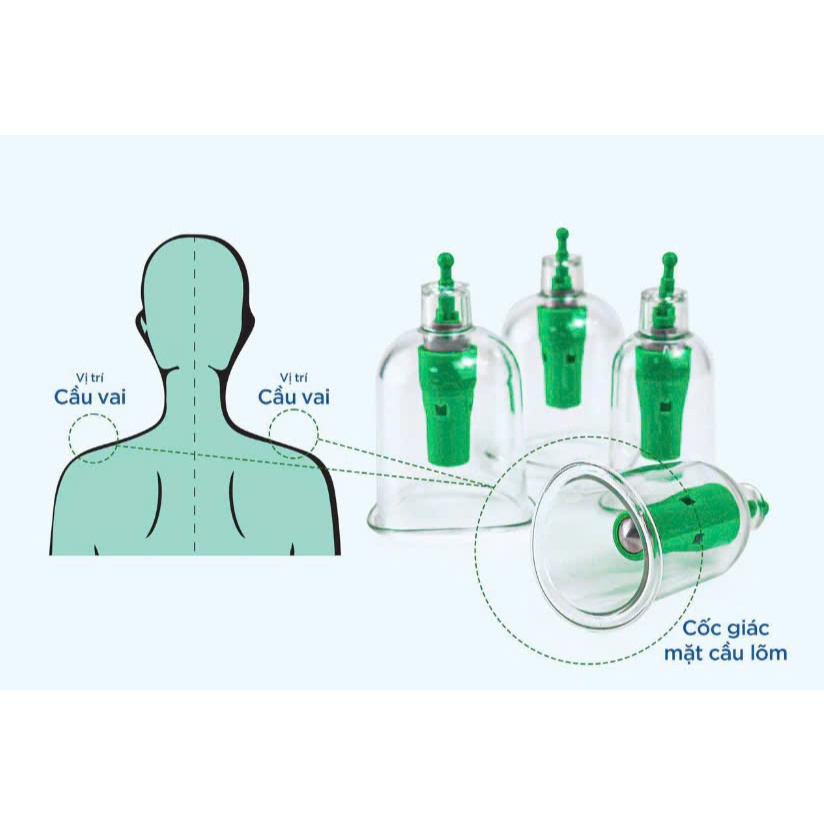 Bộ giác hơi 24 ly không dùng lửa MiDa, Dụng cụ Giác hơi không dùng lửa.