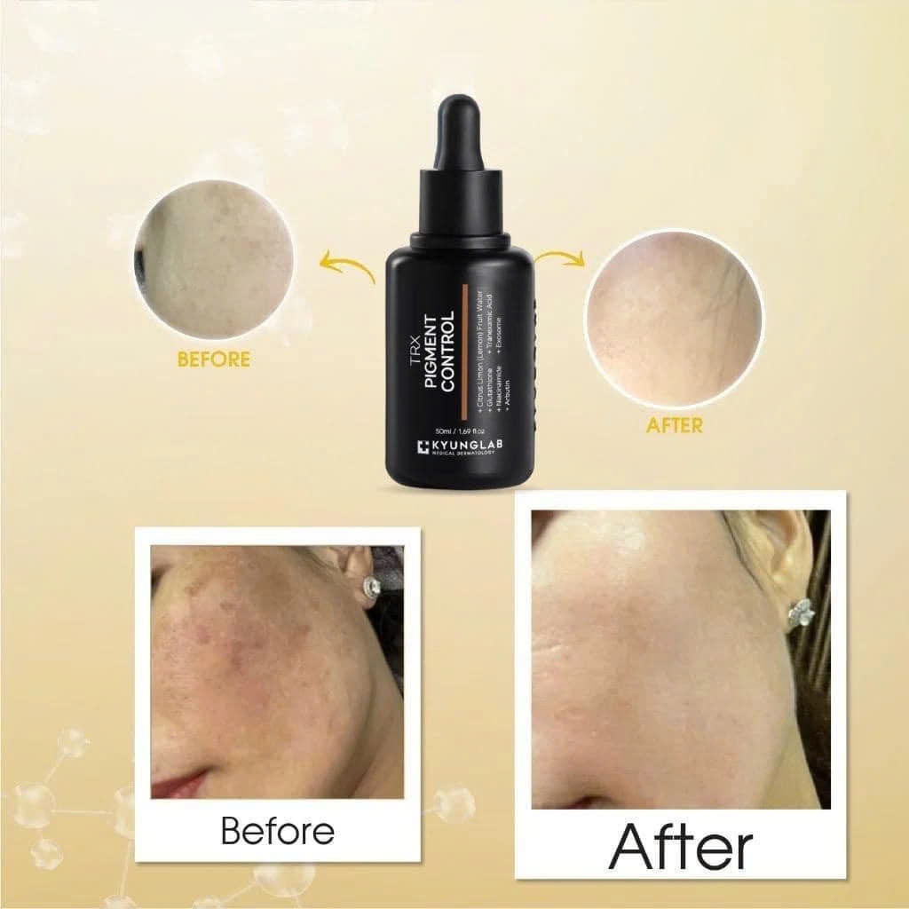 Tinh chất serum KYUNGLAB TRX PIGMENT CONTROL 50ML giảm sạm, nám, tàn nhang, giúp da trắng sáng