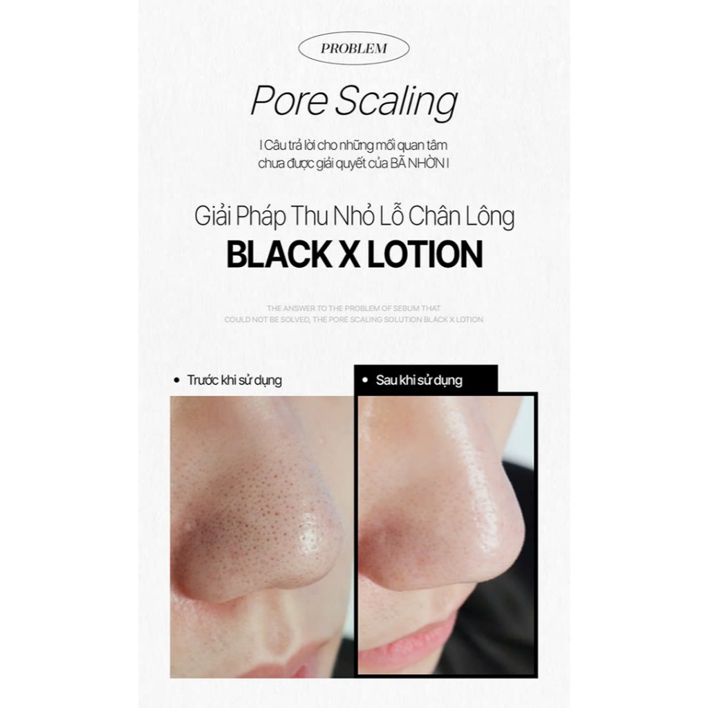 Nước cân bằng ủ mụn Black X Lotion Be'Balance làm sạch lỗ chân lông, giảm mụn bã nhờn