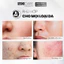 Tẩy Tế Bào Chết MD Care Mande Exfo 10ml Hỗ Trợ Làm Sáng Da, Cấp Ẩm Và Căng Bóng
