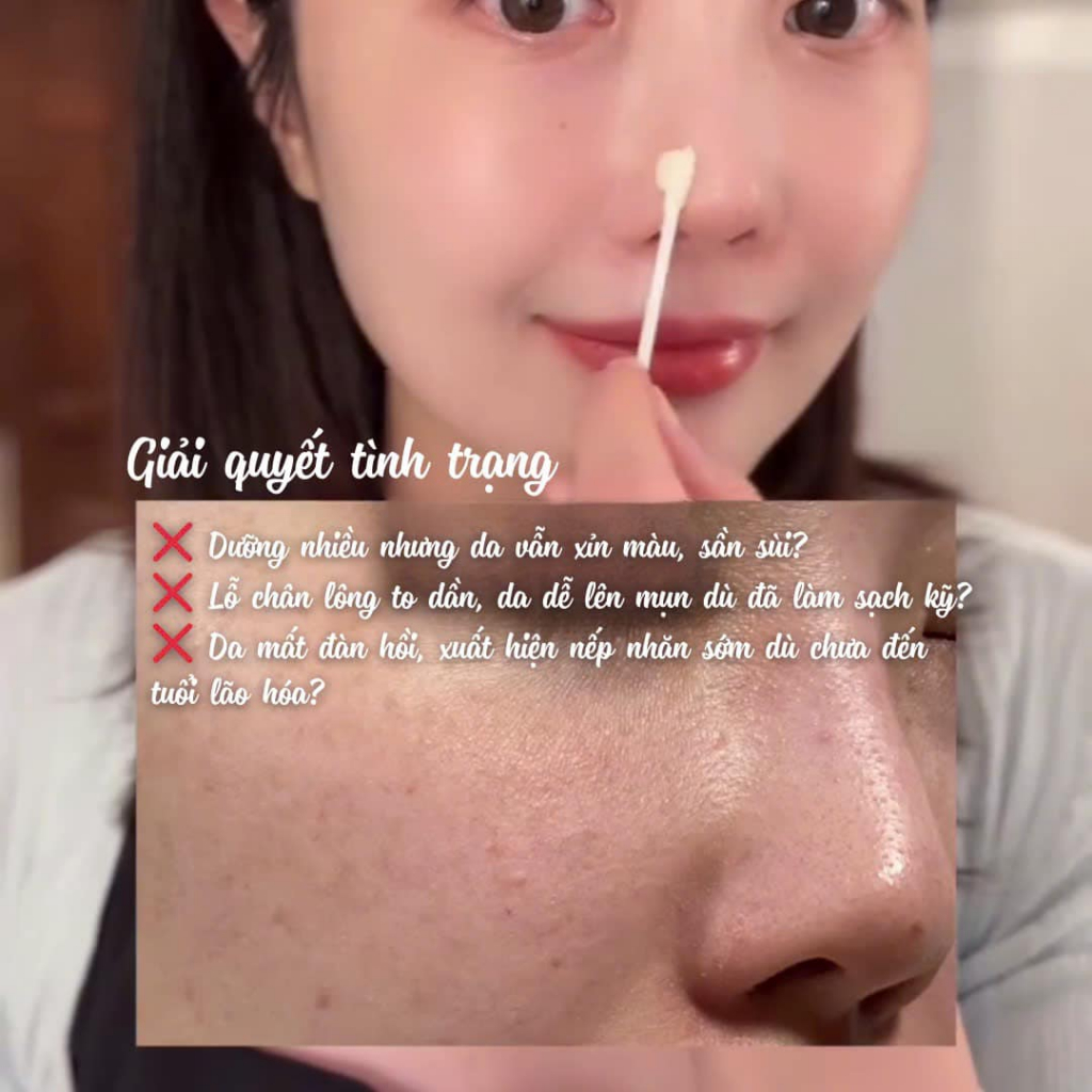 Sáp Peel Da Tẩy Tế Bào Chết Axenda Peel Routiner Hàn Quốc 75ml