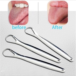 (BỘ 5 CẠO LƯỠI) THÉP KHÔNG GỈ 304, DỤNG CỤ LÀM SẠCH LƯỠI, Giúp Loại Bỏ Mảng Bám, Dễ Dàng Sử Dụng