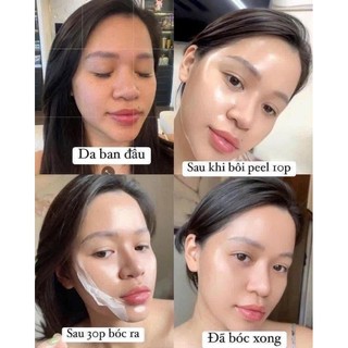 Peel Da Collagen Nano Tosowoong Căng Bóng Trẻ Hóa Fit Hàn Quốc 50ML