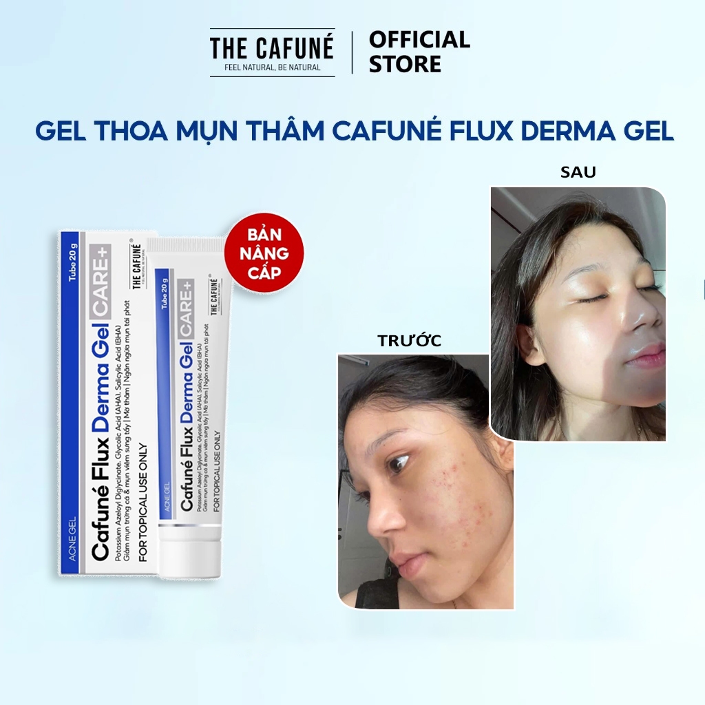 Gel Giảm Mụn Và Thâm Cafuné Flux Derma Gel 20gr