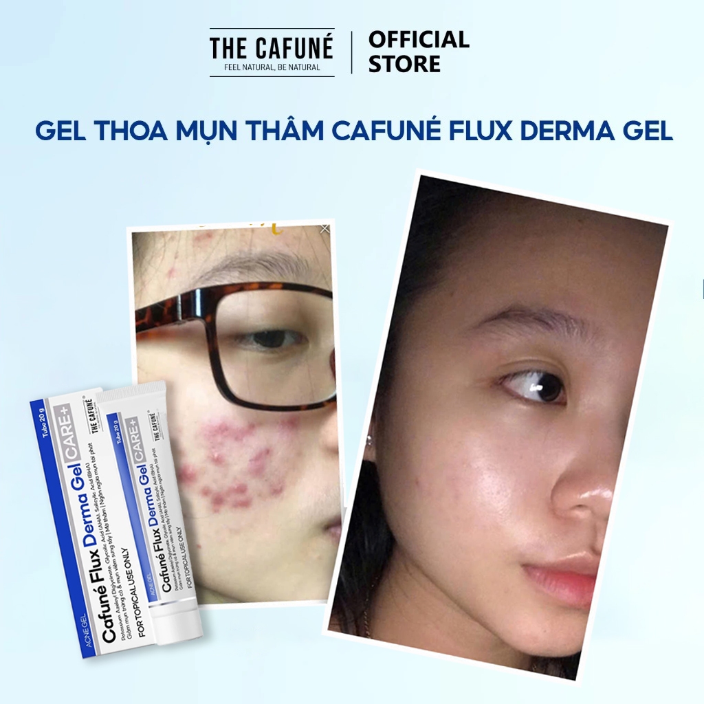 Gel Giảm Mụn Và Thâm Cafuné Flux Derma Gel 20gr