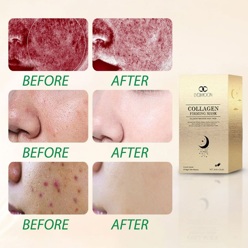 Mặt nạ ngủ Mặt nạ thạch collagen Mặt nạ làm trắng Dưỡng ẩm Chống nhăn Thu nhỏ lỗ chân lông 4ml*20pcs