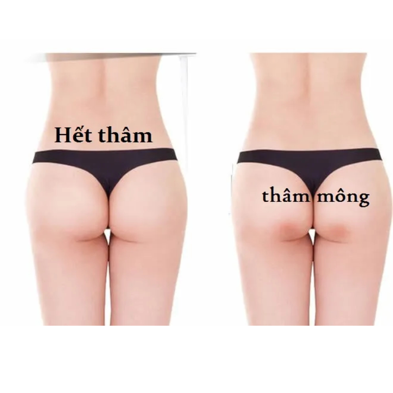 [Hộp Bự] Kem Làm Tăng Mông Nhanh Chóng 230ml Giúp Mông Cong Trắng Mịn Hết Mụn Hết Thâm Giner Hip Massage Cream