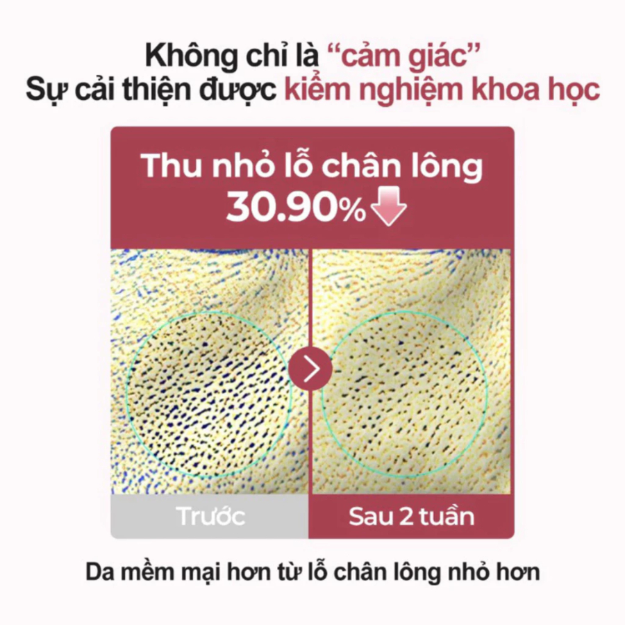 Ảnh Serum Làm Mềm Da Numbuzin No.3 – Phục Hồi Da, Cấp Ẩm Sâu, Dịu Nhẹ Cho Da Nhạy Cảm (50ml) 4