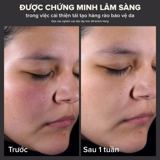 Dung dịch loại bỏ tế bào chết Paula's Choice 2% BHA 30ml