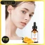 Vitamin C Melao 30ml Hỗ Trợ Làm Sáng Da, Mờ Thâm, Chống Oxy Hóa, Cải Thiện Da Xỉn Màu & Lão Hóa