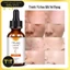 Vitamin C Melao 30ml Hỗ Trợ Làm Sáng Da, Mờ Thâm, Chống Oxy Hóa, Cải Thiện Da Xỉn Màu & Lão Hóa