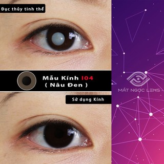 Lens thẩm mỹ - Kính áp tròng thẩm mỹ che khuyết điểm cho mắt đục thủy tinh thể, đốm trắng  tròng đen