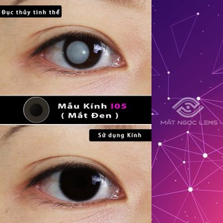 Lens thẩm mỹ - Kính áp tròng thẩm mỹ che khuyết điểm cho mắt đục thủy tinh thể, đốm trắng  tròng đen