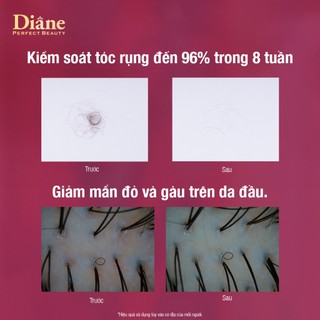 Bộ 2 gội 1 xả giảm rụng tóc đến 96% giảm gàu mẩn đỏ da đầu Moist Diane Extra Hair Fall Control