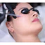 Liệu trình messotherpy căng bóng tại hãng dược mỹ phẩm medula aesthetic