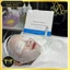 BỘ CO2 CARBON THERAPY DJ HÀN QUỐC, THẢI ĐỘC DA, GIẢM MỤN, SÁNG DA, CĂNG BÓNG DA