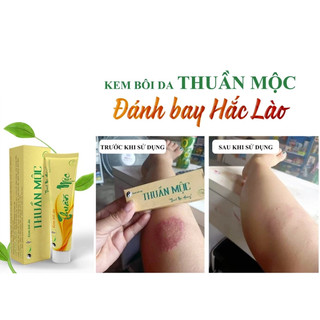 Kem bôi da Thuần Mộc - Ngừa rôm sảy, hăm da, chàm sữa (Tuýp 16g)