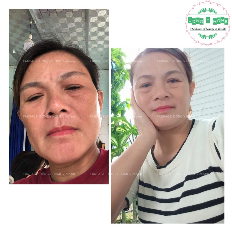 Kem Chấm Nám, Tàn Nhang Đông Y Home 20g: Hỗ Trợ Cải Thiện Thâm, Làm Đẹp Da, Skincare