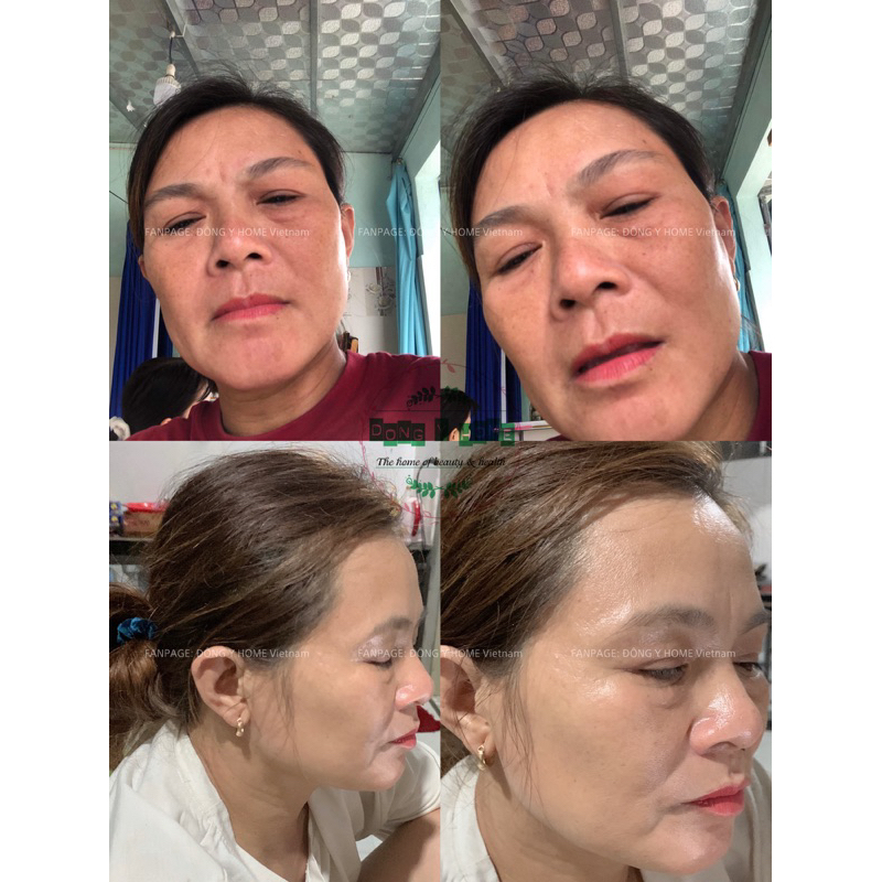 Kem Chấm Nám, Tàn Nhang Đông Y Home 20g: Hỗ Trợ Cải Thiện Thâm, Làm Đẹp Da, Skincare