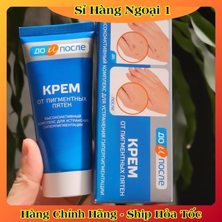 Kem đồi mồi Kpem Nga 50ml xóa mờ đồi mồi tay, tàn nhang dưỡng da tay trắng sáng mịn màng của Nga