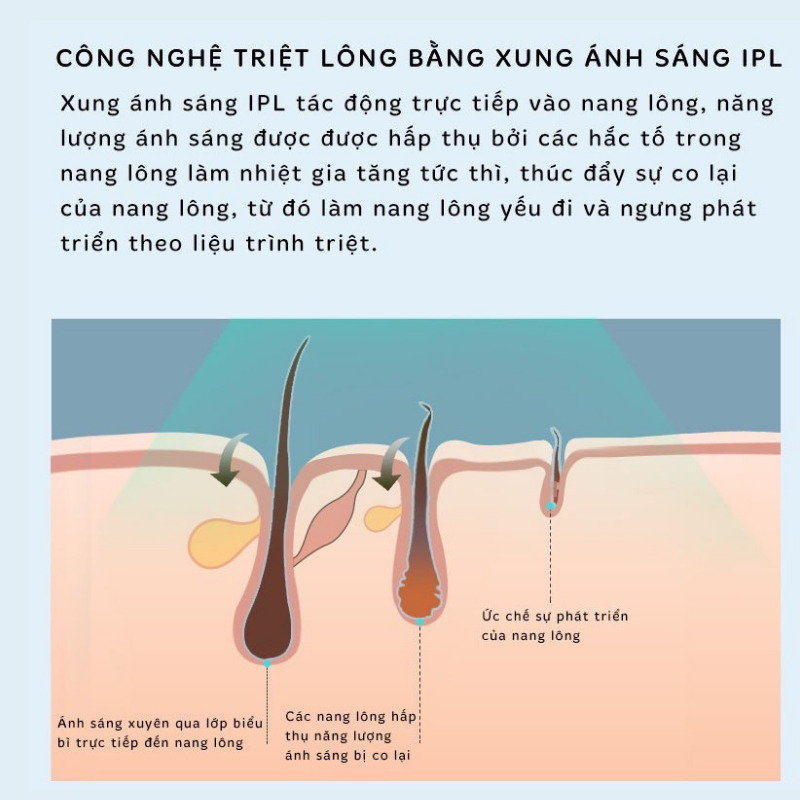 Máy triệt lông vĩnh viễn URITECH-AM001 máy triệt lông cầm tay tại nhà công nghệ pias nách vùng kín bikini chân tay | BigBuy360 - bigbuy360.vn