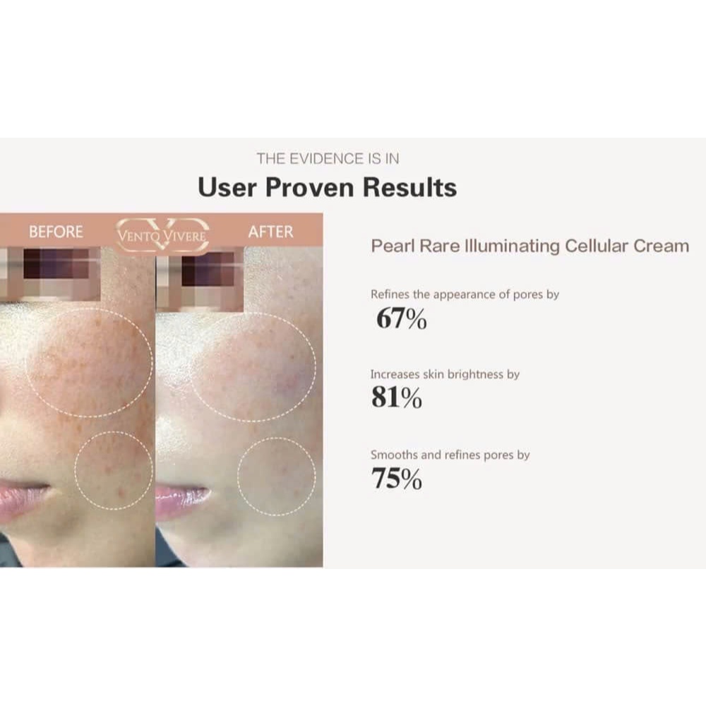 Kem Vento vàng dưỡng trắng da Vento Vivere Pearl Rare 30g, Sản Phẩm Vento Vivere Chính Hãng Thuỵ Sỹ