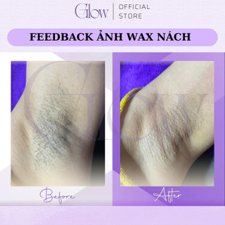 Chén Nhôm Nấu Sáp Wax Lông Glowwaxing Tiện Lợi