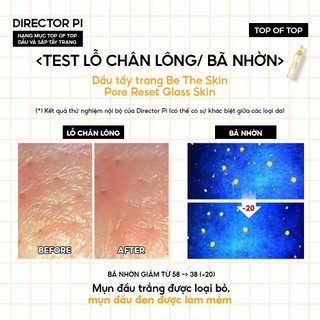 Combo Làm Sạch & hỗ trợ giảm mụn đầu đen, bã nhờn BETHESKIN (Gel tẩy tế bào chết 100g + Dầu tẩy trang Be The Skin 150ml)
