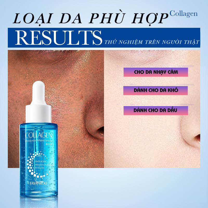 Serum Collagen Dưỡng Trắng Cấp Ẩm - Giảm Thâm, Se Khít Lỗ Chân Lông | Vitamin C + Hyaluronic Acid | Cho Da Khô Sạm Màu