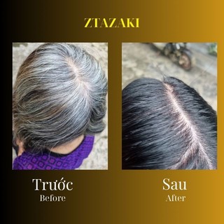 Dầu Gội đầu đen tóc, óng mượt, phủ bạc ZTAZAKI!