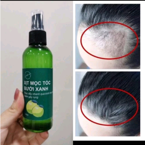 Combo Liệu Trình 3 chai xịt mọc tóc bưởi xanh