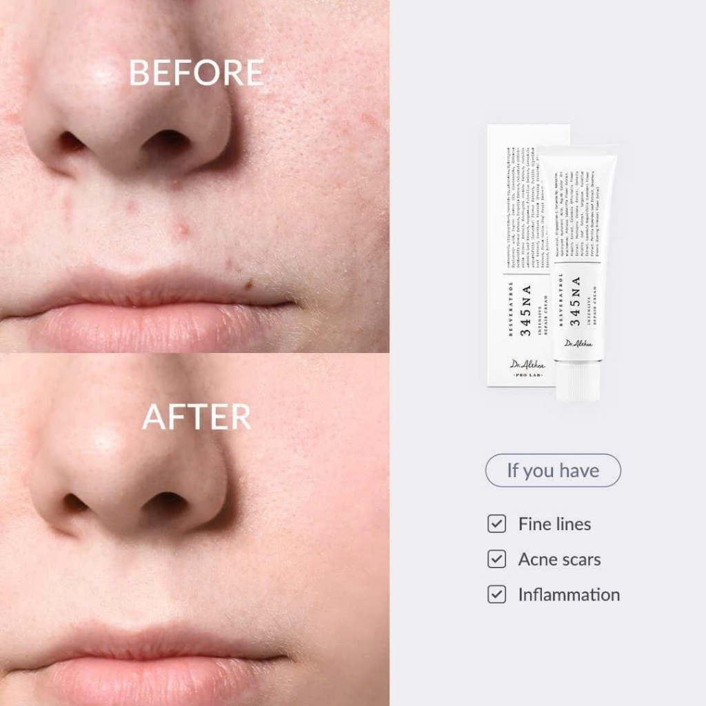 Kem dưỡng ẩm hỗ trợ làm dịu phục hồi da Dr.Althea 345 Relief Cream thuần chay 50ml