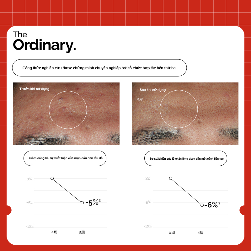The Ordinary tinh chất dưỡng sáng da giảm mụn, mờ thâm Niacinamide 10% + Zinc 1% [30ml] Chính Hãng