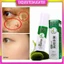 Chai xịt Melanin xóa nám tàn nhang 377, Giúp cải thiện các vết nám da, dưỡng ẩm cho da, giúp da trắng sáng, 100ml