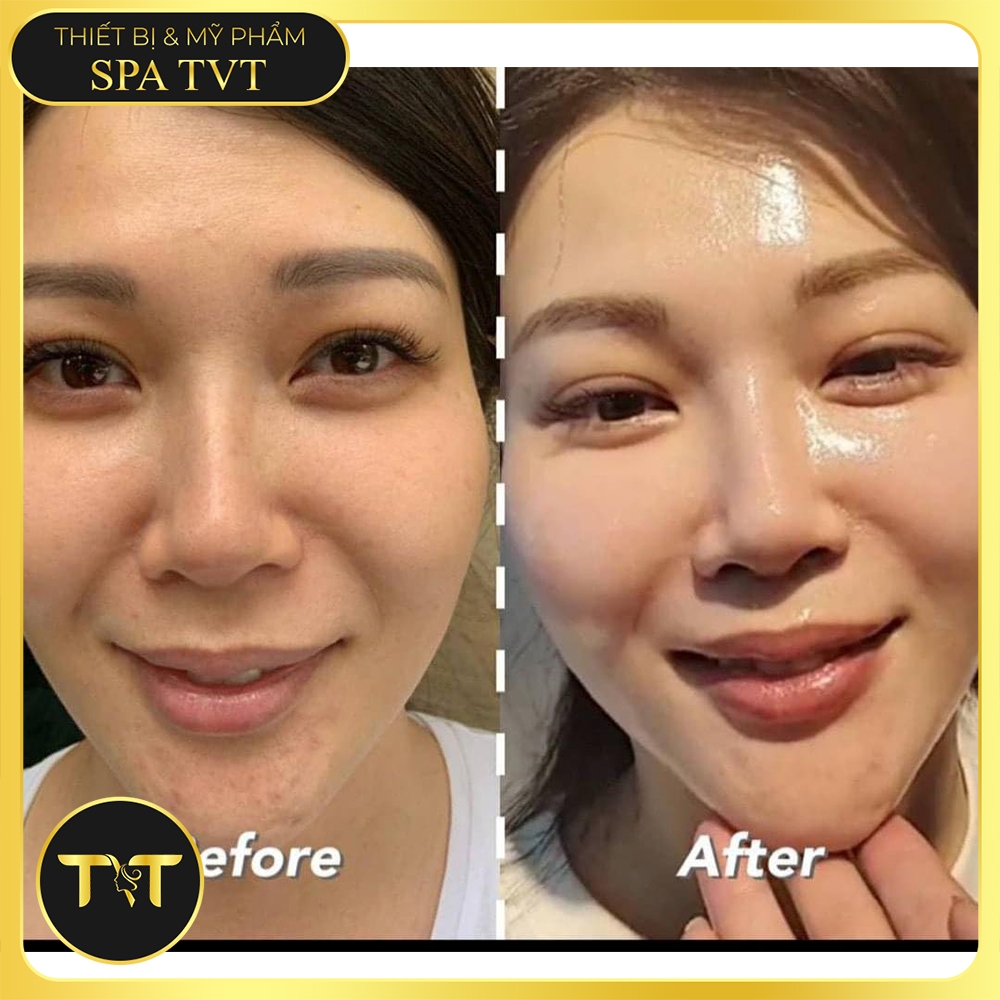 POCIA SE KHÍT LỖ CHÂN LÔNG 10ML, TINH CHẤT THU NHỎ LỖ CHÂN LÔNG, GIẢM NHĂN