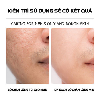 Sữa Rửa Mặt Nam Da Dầu Hỗ Trợ Ngừa Mụn - Trắng Da Sạch Mụn Kiểm Soát Dầu Làm Sạch Sâu Và Dưỡng Ẩm 150ml