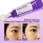 Bộ Tinh chất dưỡng + Kem dưỡng mắt SOME BY MI Retinol 0.1% 30ml Tím Chống Lão Hóa, Cải Thiện Nếp Nhăn, Sáng Da — ảnh 6