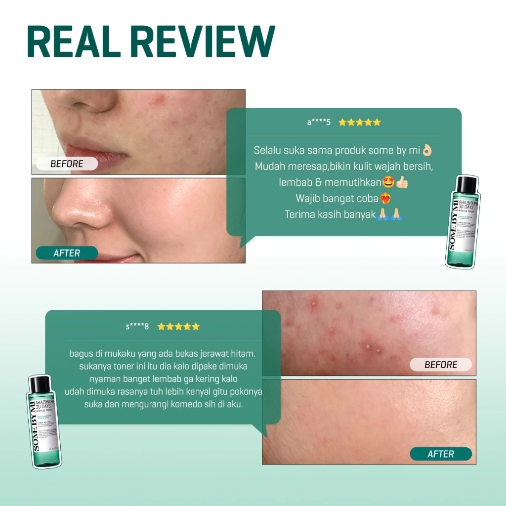 Nước hoa hồng SOME BY MI Aha Bha Pha 30 Days Miracle Toner 150ml SOME BY MI Aha Bha Pha 30 Days Miracle Toner