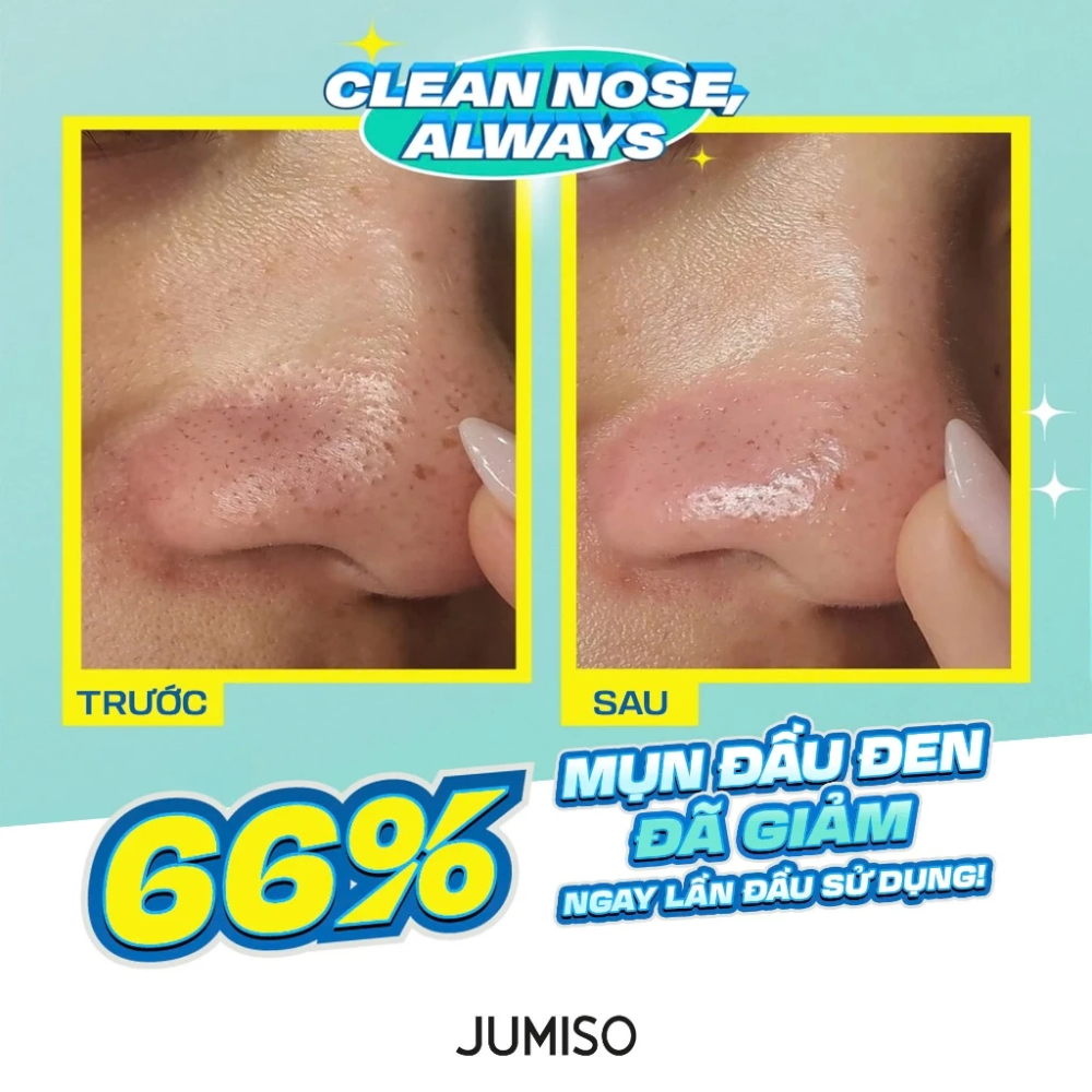 Ảnh Tinh chất ủ mụn đầu đen Jumiso Blackhead Melting Softener Special Kit 150ml làm sạch bã nhờn và mụn đầu đen hiệu quả 2