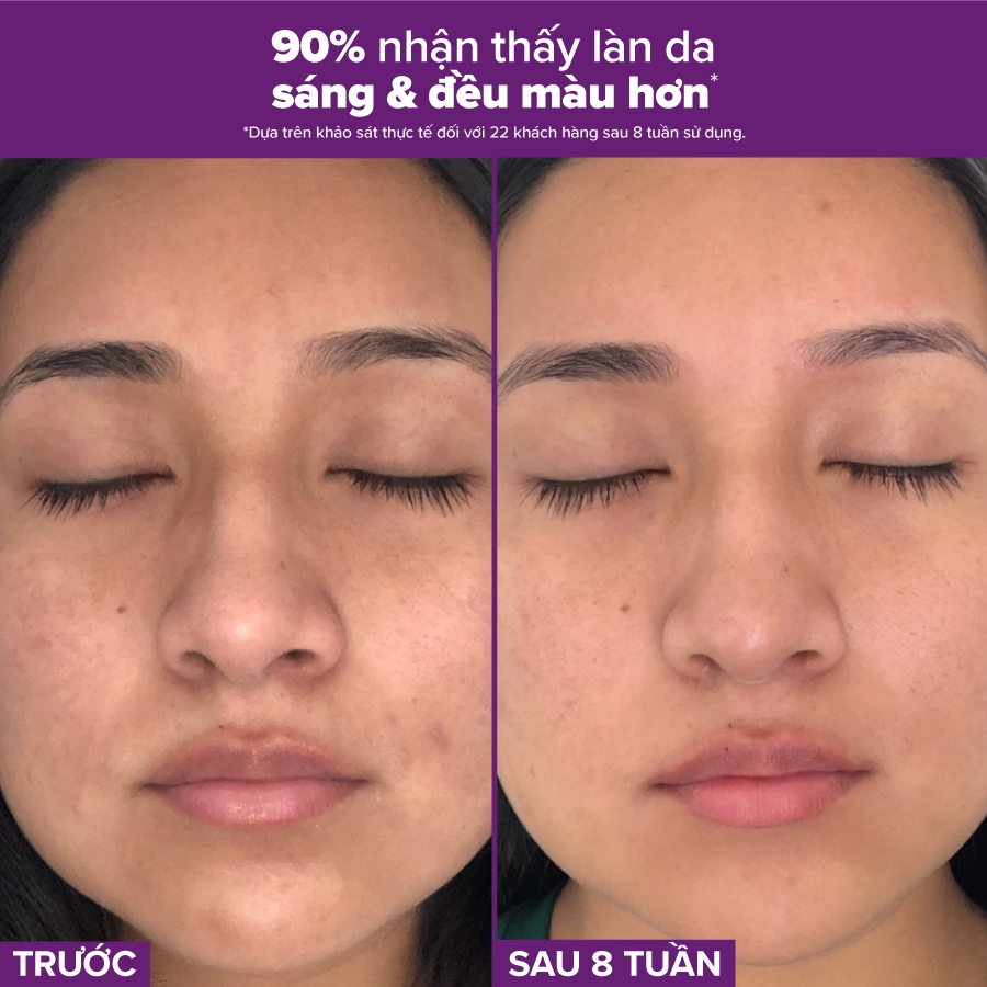 Ảnh Tinh chất se khít lỗ chân lông tối ưu Paulas Choice Niacinamide 20% Treatment 2ml 78032.1 2