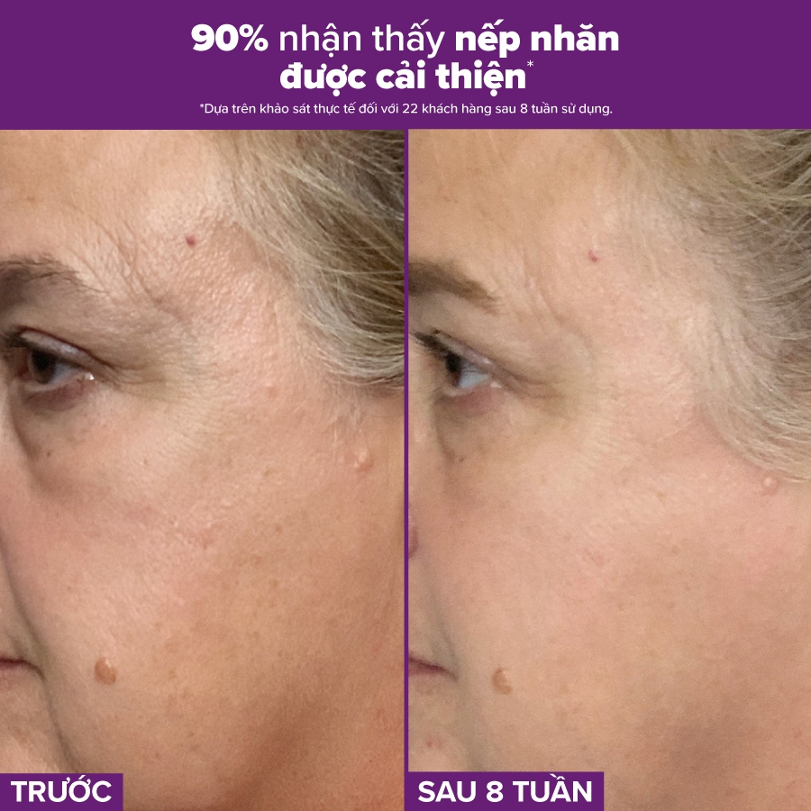 Ảnh Tinh chất se khít lỗ chân lông tối ưu Paulas Choice Niacinamide 20% Treatment 2ml 78032.1 3
