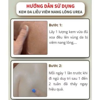 Combo 2 Kem Bôi Viêm Nang Lông UREA 200ml, Kem Bôi Da UREA hỗ trợ đào thải bít tắc lỗ chân lông, làm sạch sâu, cấp ẩm