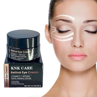 Kem Mắt - Retinol Eye Cream, Dưỡng Vùng Da Mắt “Giúp Giảm Bọng Mắt, Giảm Thâm Quần Mắt, Giảm Nếp nhăn và Nếp Chân Chim
