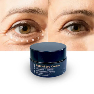 Kem Mắt - Retinol Eye Cream, Dưỡng Vùng Da Mắt “Giúp Giảm Bọng Mắt, Giảm Thâm Quần Mắt, Giảm Nếp nhăn và Nếp Chân Chim